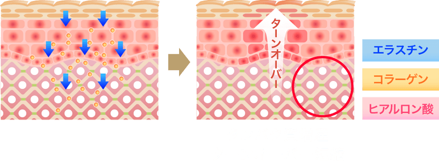 タンパク質増産 ターンオーバー短縮